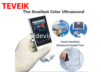 Medical Wifi Ultrasound Machine Android Portable Wireless Ultrasound Probe Linear