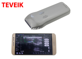 Portable Wireless Ultrasound Probe Medical Ultrasonic Convex Probe Doppler Scanner