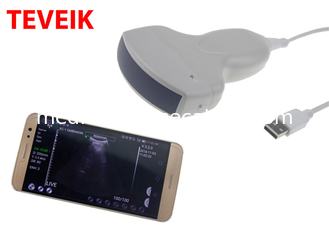 color Wireless Wifi Ultrasound Machine  Protable wireless ultrasound probe Convex